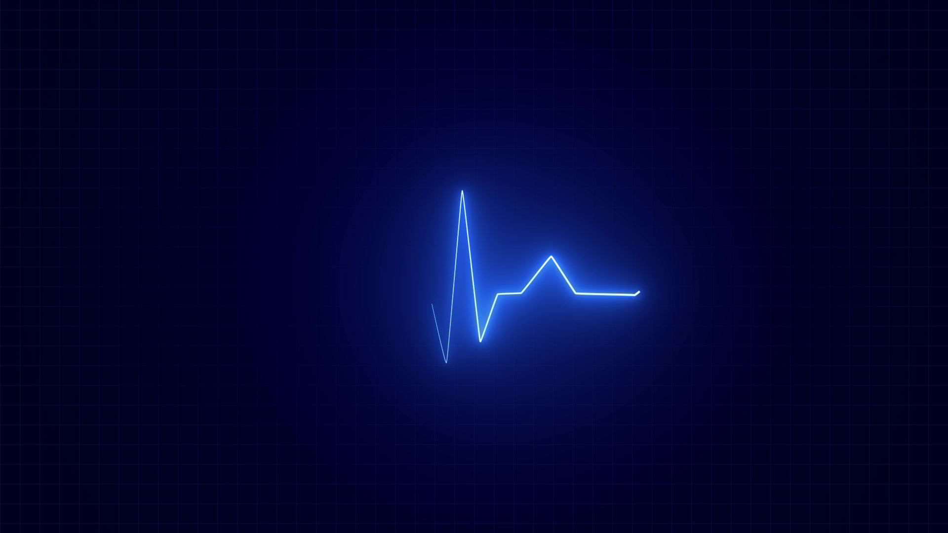 EKG/ECG